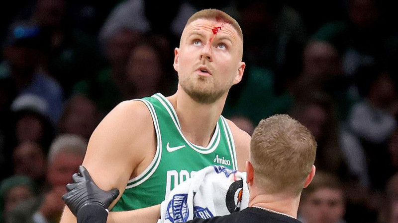 Kristaps Porzingis' Bloody Playoff Moment Ignites Celtics Crowd-Here's What Happened Next