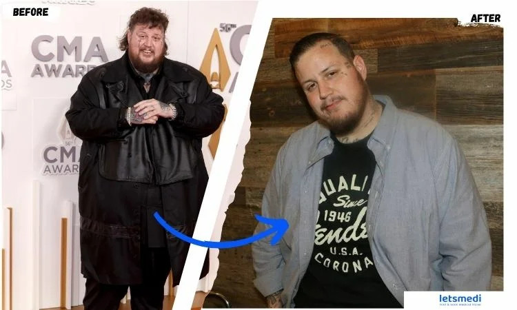 Jelly Roll: The Unconventional Weight Loss Journey