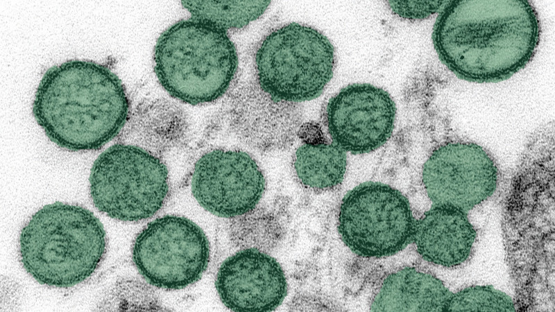 Hantavirus in the US: The Current State of a Deadly Disease
