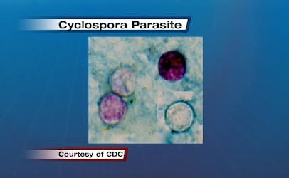 Cyclospora Parasite Outbreak: FDA Investigates Rising Cases of Gastrointestinal Illness