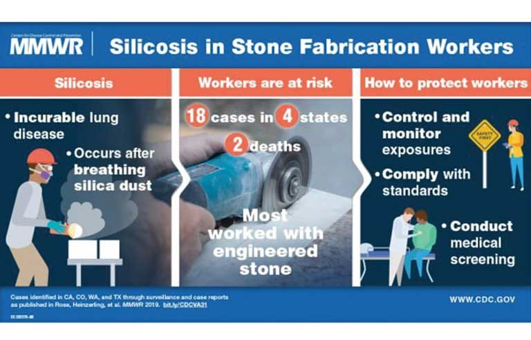 California's Engineered Stone Silicosis Crisis: A Silent Epidemic Amidstone Fabrication