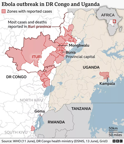 Ebola Resurgence: A Deadly Wave Sweeps the Democratic Republic of Congo